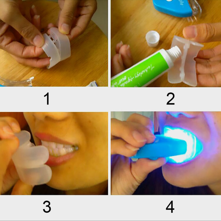 LED-Lichttherapie Mundschleimhaut Zahnaufhellungsgel