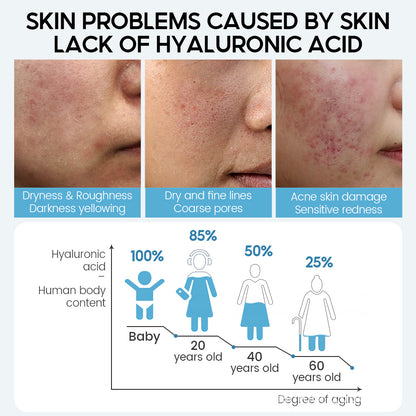 Anti-Aging Porenverfeinerndes, feuchtigkeitsspendendes Hyaluronsäure-Gesichtsserum