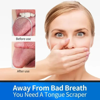 U-förmiger Zungenschaber Mundpflege-Werkzeuge Edelstahl Sauberer Mund Saubere Zunge Bürste Schlechter Atem Zunge Zungenreiniger